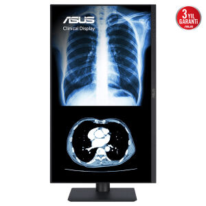 ASUS 27 IPS MH2741A 5MS 75HZ HDMI-DP TYPEC Pivot Klinik Monitör 2560x1440